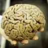 De ziekte van Alzheimer en voeding